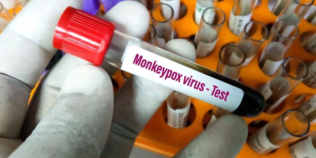 ECDC advarer: Hvis dette skjer, kan monkeypox bli en permanent sykdom i Europa