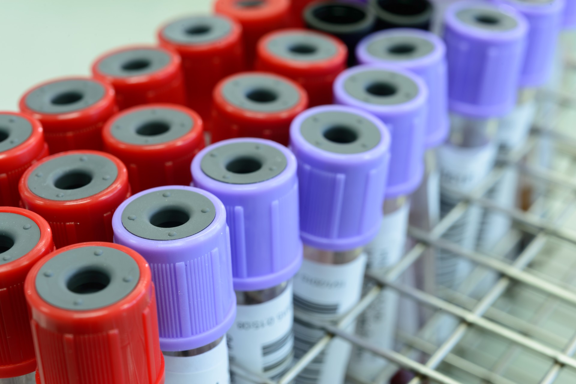 Sensasjon: Nordmann kurert for HIV
