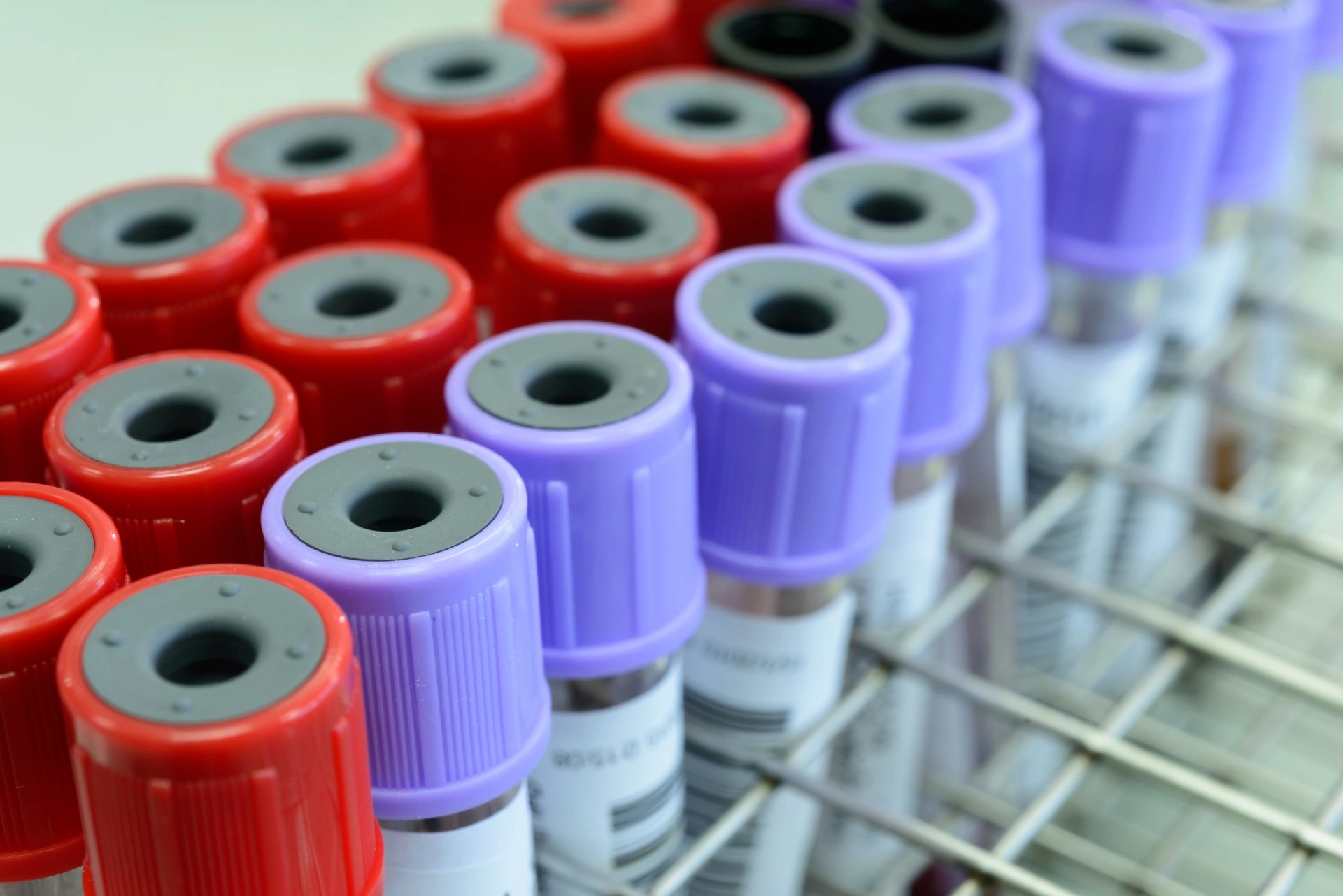 Sensasjon: Nordmann kurert for HIV