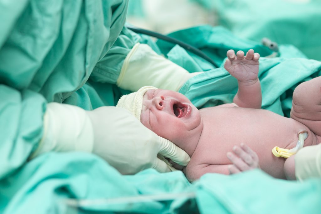 Mor får 135 millioner kroner i erstatning: ’Sykepleier prøvde å presse baby tilbake i vaginaen min’