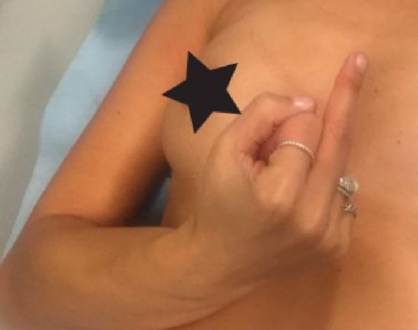 Louise har tatt beslutningen: «Bare gi meg de plastikk-puppene og la oss få det overstått