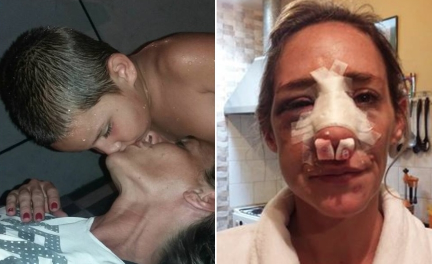 Mor ville bare gjøre sin 3-årige sønn glad: Bilder viser det fryktelige resultatet