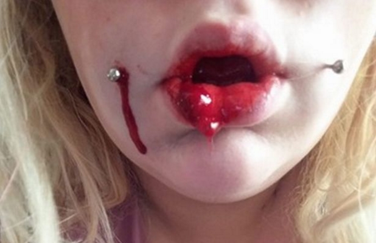 Tenårings besøk hos en piercer tok en fryktelig vending: Etterlatt med blodig og hovent ansikt