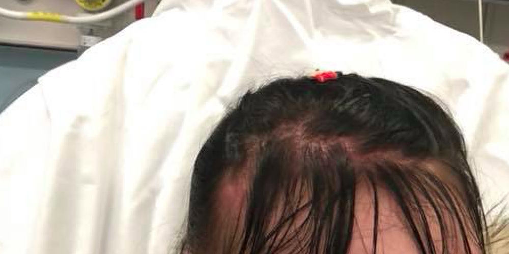 Mor brukte populært skjønnhetsprodukt: Da hun gikk ut av badet om morgenen, fikk hun helt panik