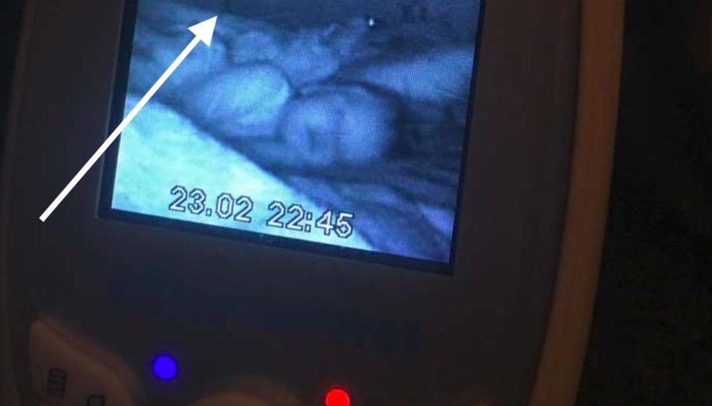 Ung mor gjorde grøssende oppdagelse på babyalarmens skjerm