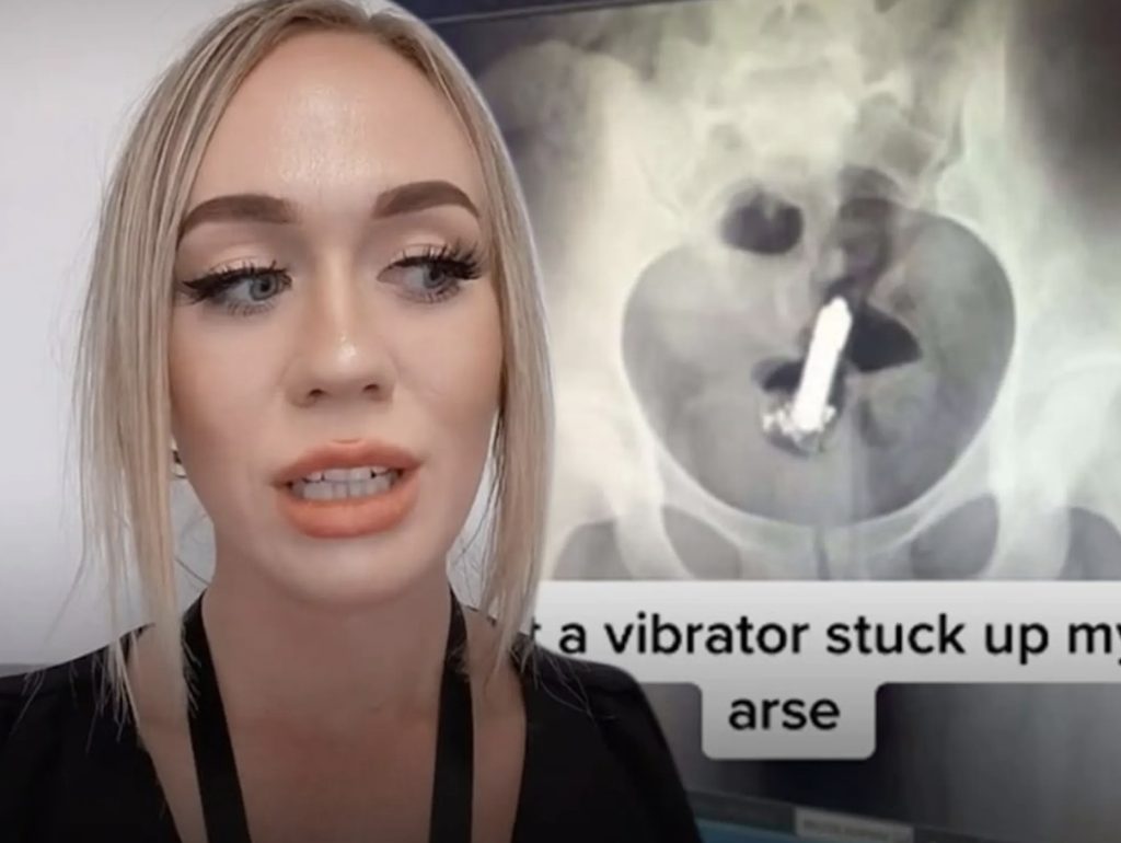 TikTok Stjerne i bisarre operasjon: Vibrator satt fast i rumpehullet