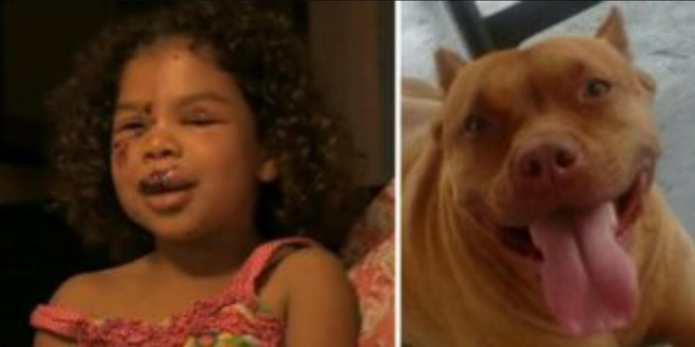 5-åringen blir bitt av naboens labrador: Det satt gang i familiens Pitbull, som gjør det utenkelige