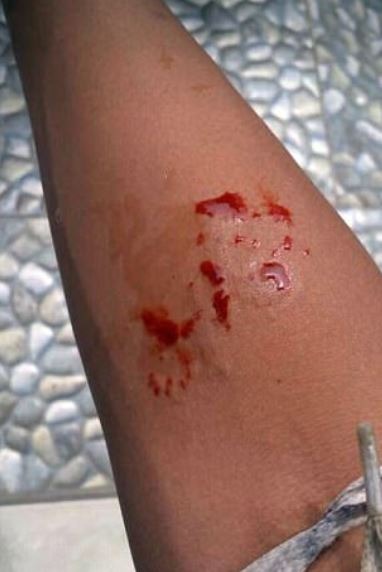 Gutt på 14 år deler bilder på sosialt medie: Få timer senere er han død