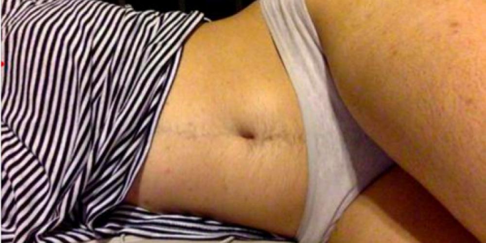 Kvinne la ut to bilder av seg selv i truser på nettet: Fikk folk til å gå i selvsving