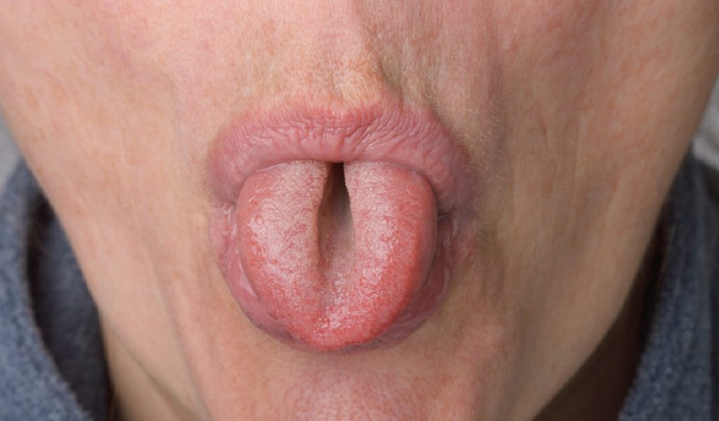 Du er ikke ‘normal’ hvis du kan svare “ja” på disse 6 tingene