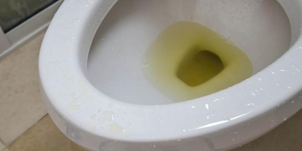 Kjenn tisset ditt: Dette sier urinens farge om kroppen din