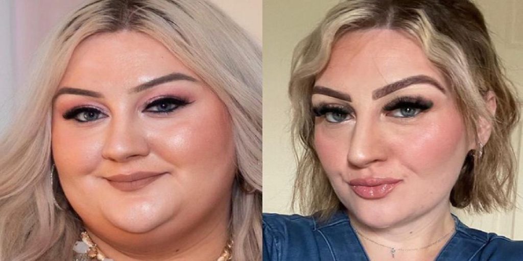 Victoria veide 171 kilo og gikk ned 85 kilo: Det var starten på et helvete for henne