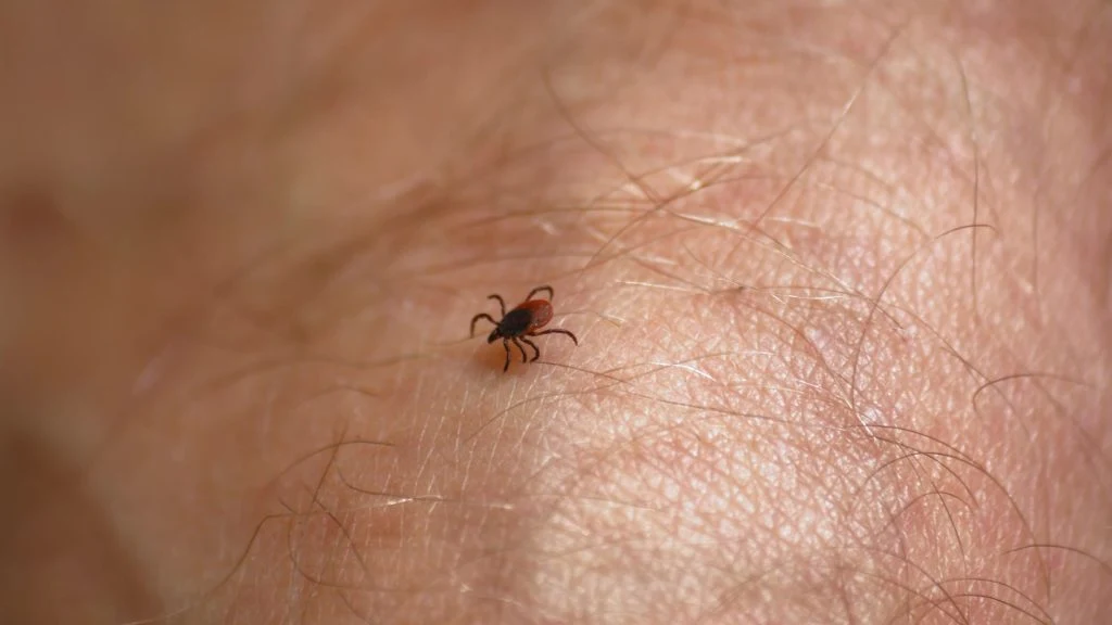Aldri før har så mange fått borreliose i juli